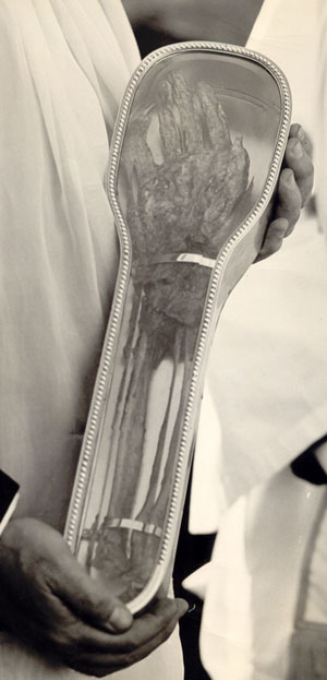 St. Francis Xavier's Arm 